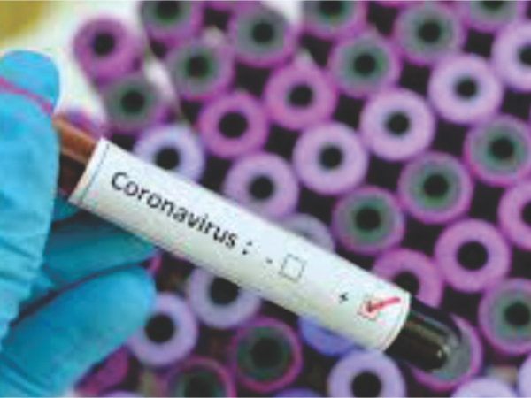 Corona Vírus – Como sua empresa deve se preparar?