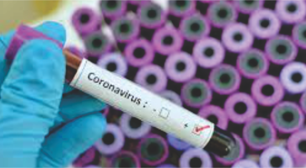 corona-virus-como-sua-empresa-deve-se-preparar